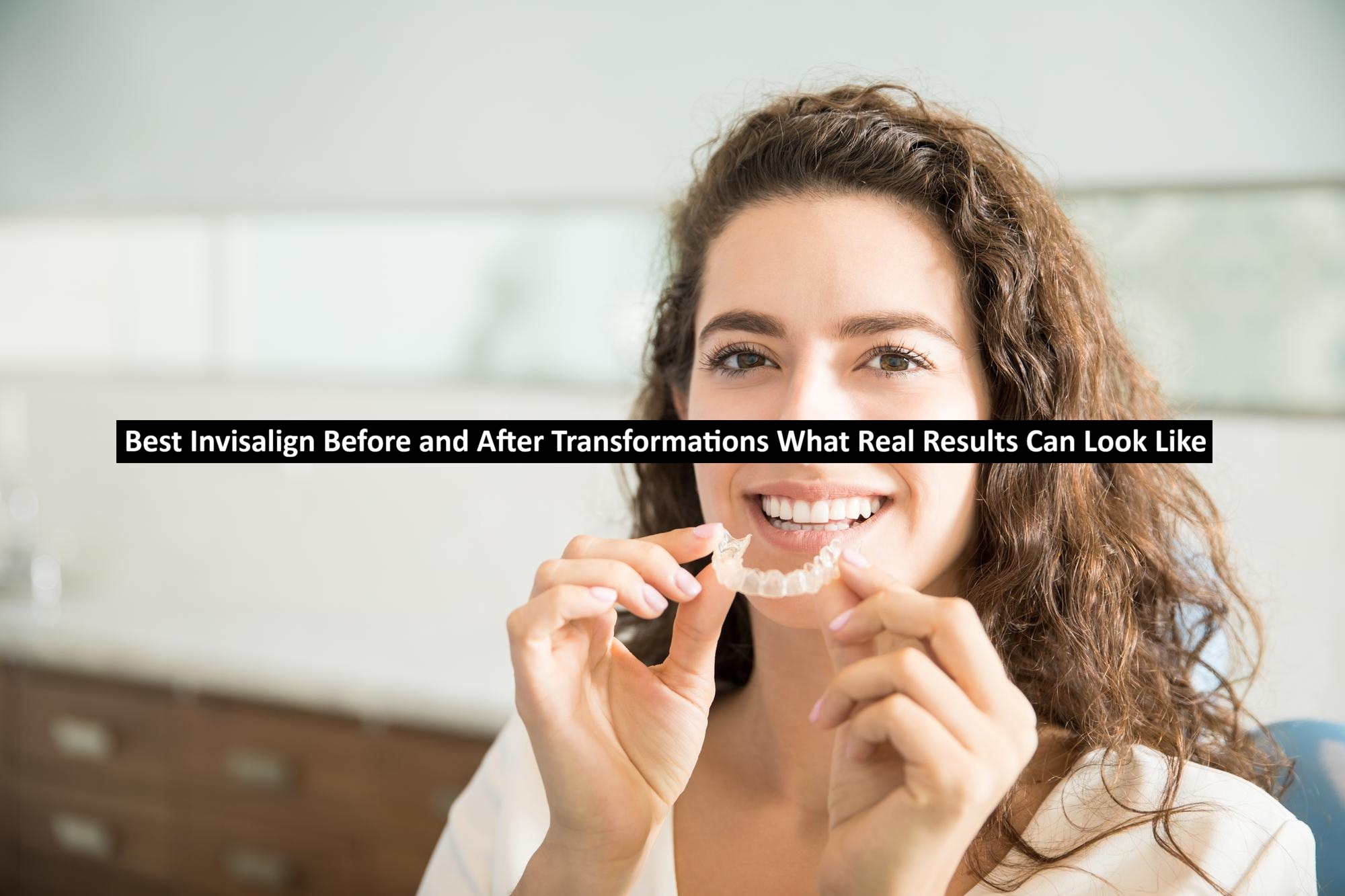 Best Invisalign Before and After Transformations What Real Results Can Look Like